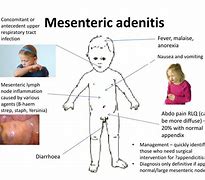 Image result for adenifis