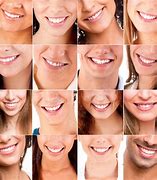 Image result for Smile Types