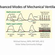 Image result for Mechanical Ventilation PPT