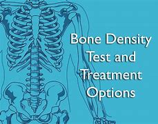 Image result for Bone Density Test Kit