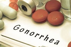 Image result for Gonorrhea