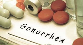 Image result for Gonorrhoea