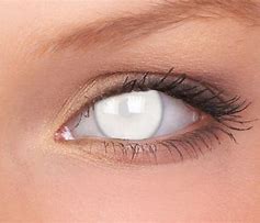 Image result for Blinding Lenses