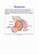 Image result for hematosis