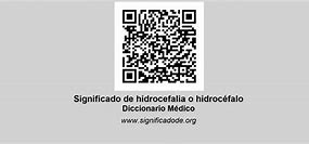 Image result for hidroc�falo