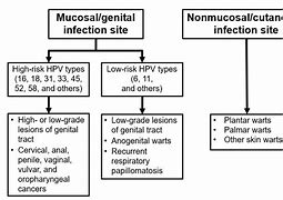 Image result for Human Papillomavirus Symptoms in Men