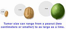 Image result for How Big Is 12 Cm Tumor