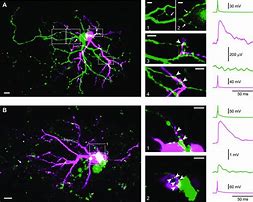 Image result for Synapse Confocal