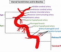 Image result for Segments Internal Carotid Artery Anatomy