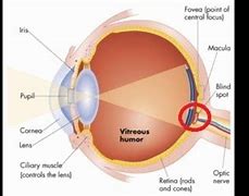 Image result for Blind Spots in Vision Look Like