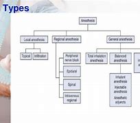 Image result for Regional Anesthesia Types