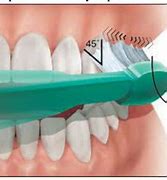 Image result for Tooth Extraction and Brushing Technique