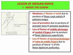 Image result for Elbow Nerve Anatomy