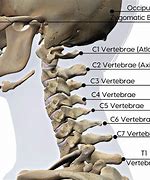 Image result for C5 C6 C7 Neck Symptoms