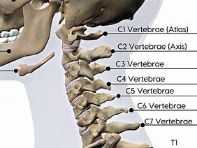 Image result for C4 Spinal Injury