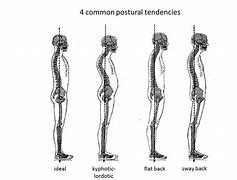 Image result for Kyphosis Back Brace for Posture