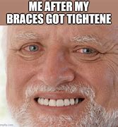 Image result for Braces Pain Meme