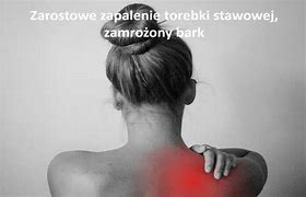 Image result for co_to_za_zarostowe_zapalenie_tętnic