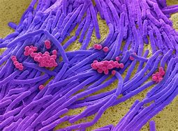 Image result for Pictures of Bacteria Pulled From Cell Phone Under Microscope