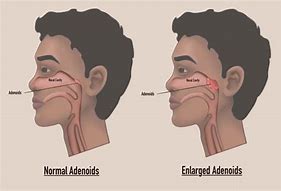 Image result for adetosidad