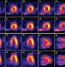 Image result for SPECT Cover