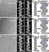 Image result for actin�metto