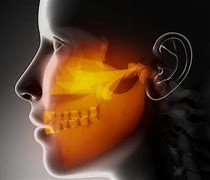 Image result for Upper Jaw Surgery