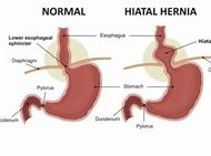Image result for hienal