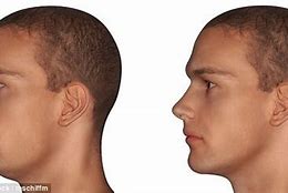 Image result for People with No Jawline