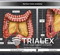 Image result for Colon Location by Cm