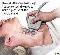 Image result for thyroid ultrasound pics
