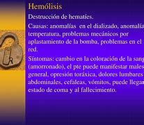 Image result for hemodi�lisis