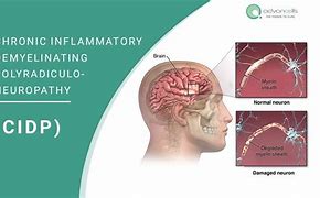 Image result for amino�cidp