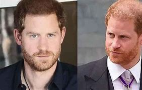 Image result for Prince Harry New Hair