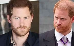 Image result for Prince Harry Helps with Hair