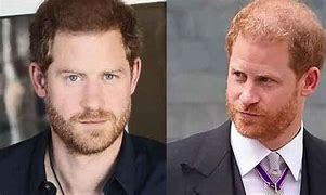 Image result for Prince Harry Has New Hair
