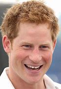 Image result for Prince Harry Thinning Hair