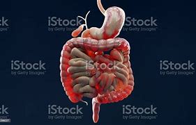 Image result for Inflated Large Intestine
