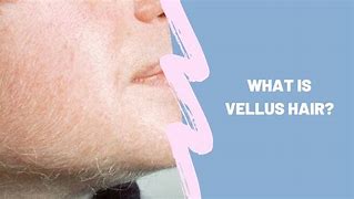 Image result for Vellus Hair Women Arm