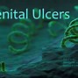 Image result for Venereal Ulcer