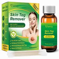 Image result for Tag Free Skin Tag Remover