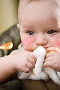 Image result for Baby Allergy to Carrot Juice