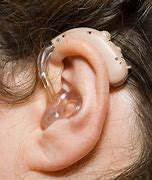 Image result for Over the Counter Hearing Aids
