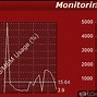 Image result for HP Hardware Diagnostics Windows