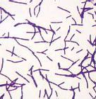 Image result for Gram-positive Bacilli Chart