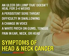 Image result for Neck Pain Cancer Sign