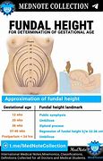 Image result for Fundal Height Cm