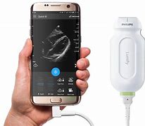 Image result for Portable Ultrasound Phone Scanner Android