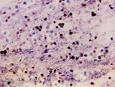 Image result for Covid Bacteria