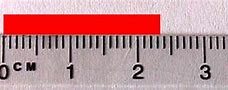 Image result for 2 mm On Ruler